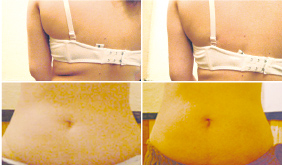 Acupuncture&Esthetic�@AQUNEED�i�A�L���j�[�h�j
